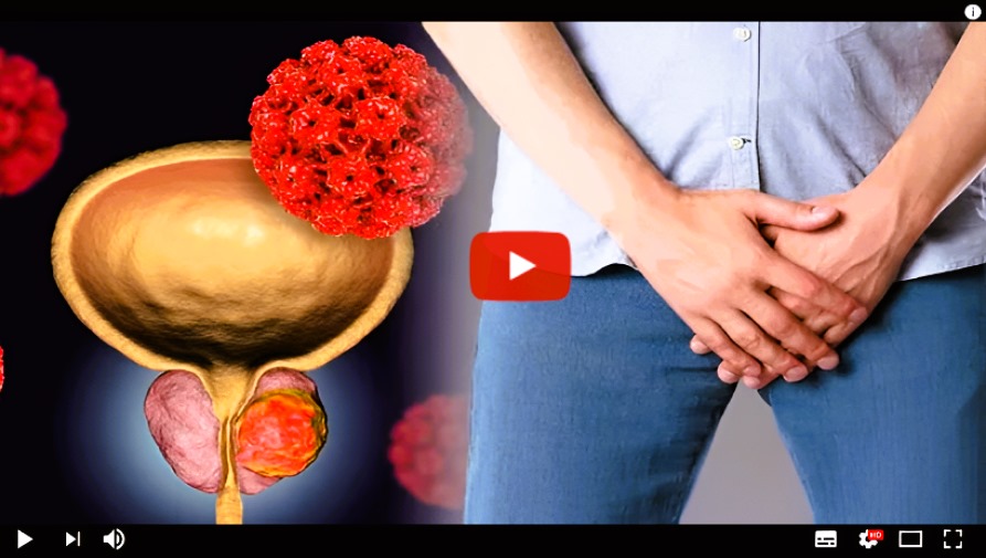 ADVARSEL: Forskere fra Fukushima University of Japan nettopp bevist at denne stille tresko er den virkelige årsaken til BPH i millioner av menn. Se video! ADVARSEL Forskere fra Fukushima University of Japan Bare bevist at denne stille tregen er den virkelige årsaken til BPH i millioner av menn se video